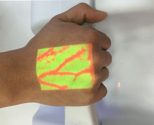 Understanding Vein Visualization Technology for Enhanced Patient Care