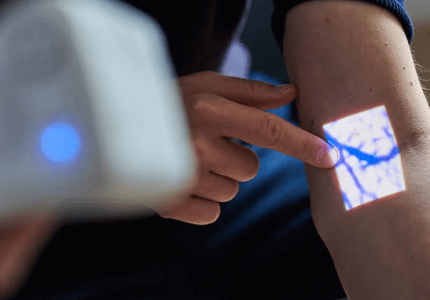 aimvein-portable-vein-finder-injection