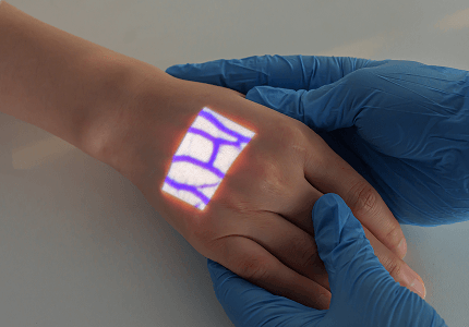 aimvein pro 2.0 pre iv scan on hand
