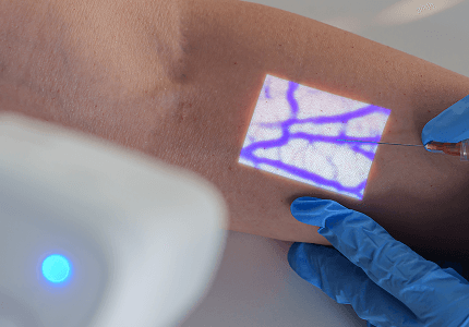 Aimvein Pro 2.0 Vein Finder For Arm