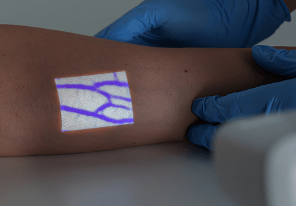 Aimvein Pro 2.0 Vein Finder on Patient Arm