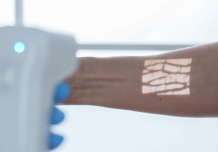 aimvein pro 2.0 vein viewer for phlebotomy arm