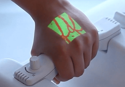 aimvein-vein-imaging-device-phlebotomy