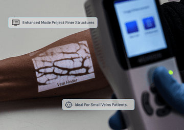 high-accuracy-vein-finder-shows-fine-details