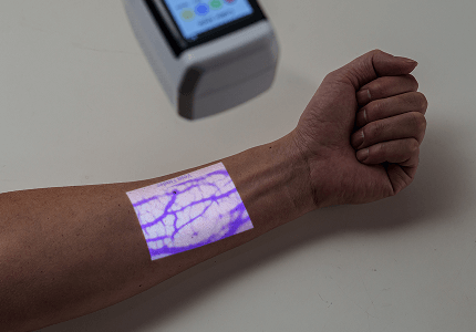 vein-visualizer-for-geriatric-care