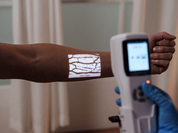 Los 19 mejores detectores de venas (2025)