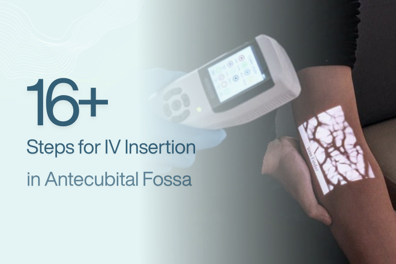 Iv In The Ac 16+ Essential Steps for IV Insertion in the Antecubital Fossa | Aimvein®