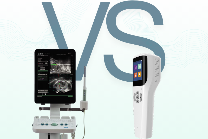 Ultrasound vs. Vein Finder: Choosing the Right Tool for Vascular Success