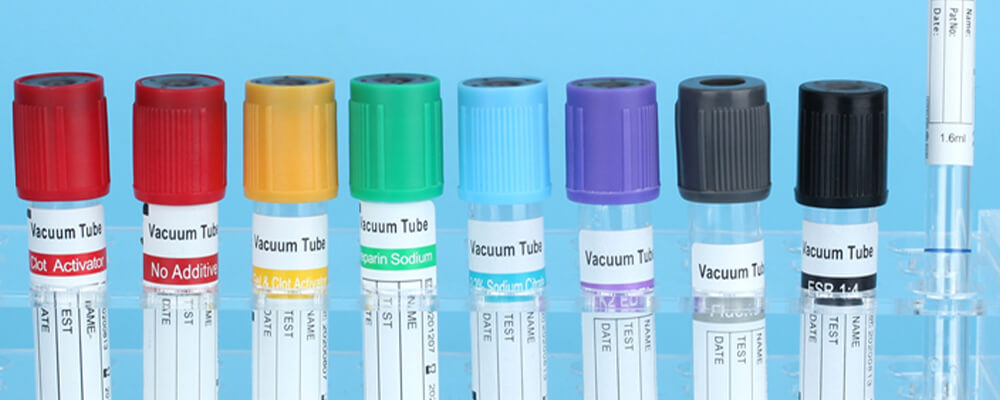 About Vein Finder Phlebotomy