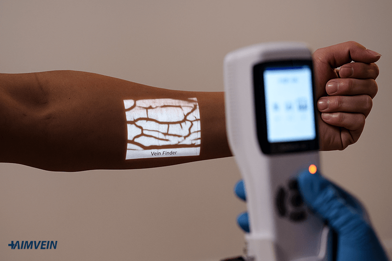 19 Best Vein Finders 2026