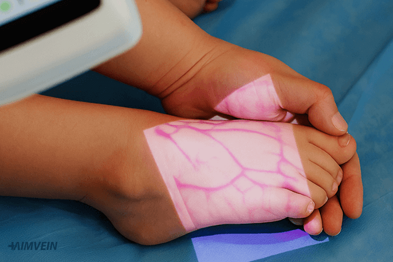 Best Vein Finder for Pediatric Patients in 2025