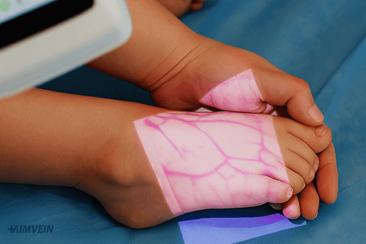 Best Vein Finder for Pediatric Patients in 2025
