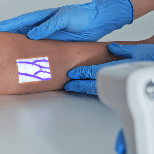 Aimvein Pro 2.0 Vein Finder Machine