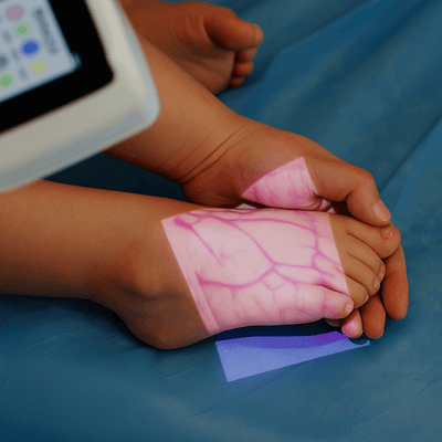 Child Foot Veins