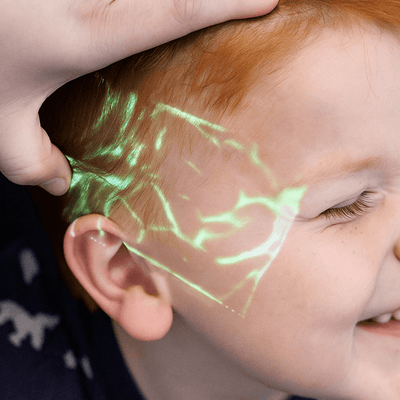 Child Scalp Veins