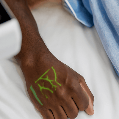 Dark Skin Hand Veins