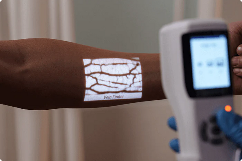 Iv In The Ac 16+ Essential Steps for IV Insertion in the Antecubital Fossa | Aimvein®