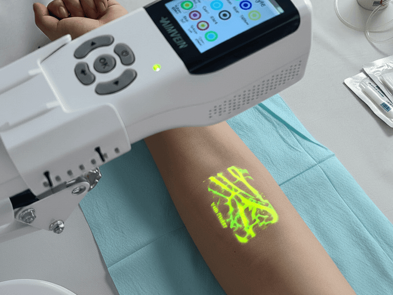 Vein finder image