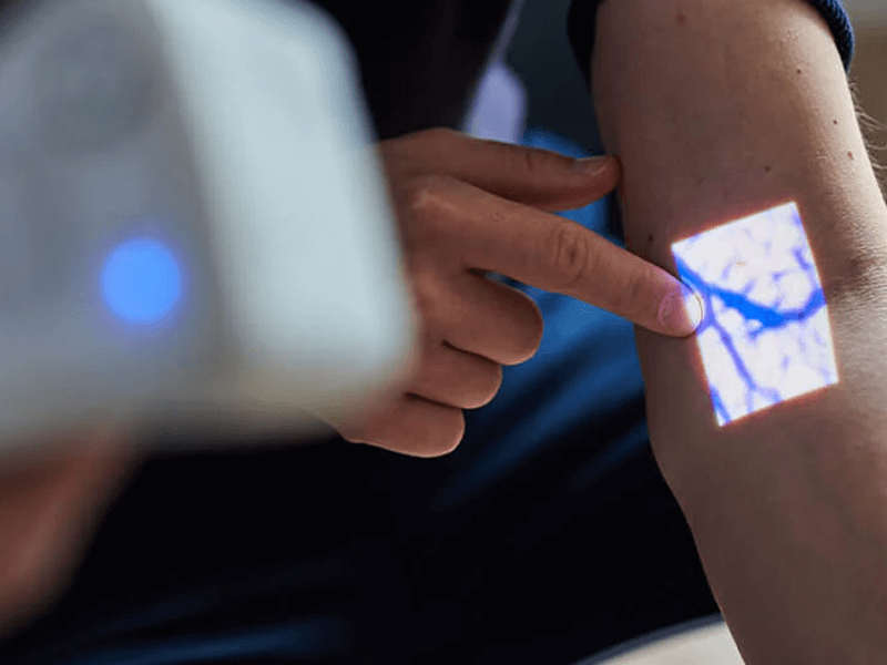Vein finder image