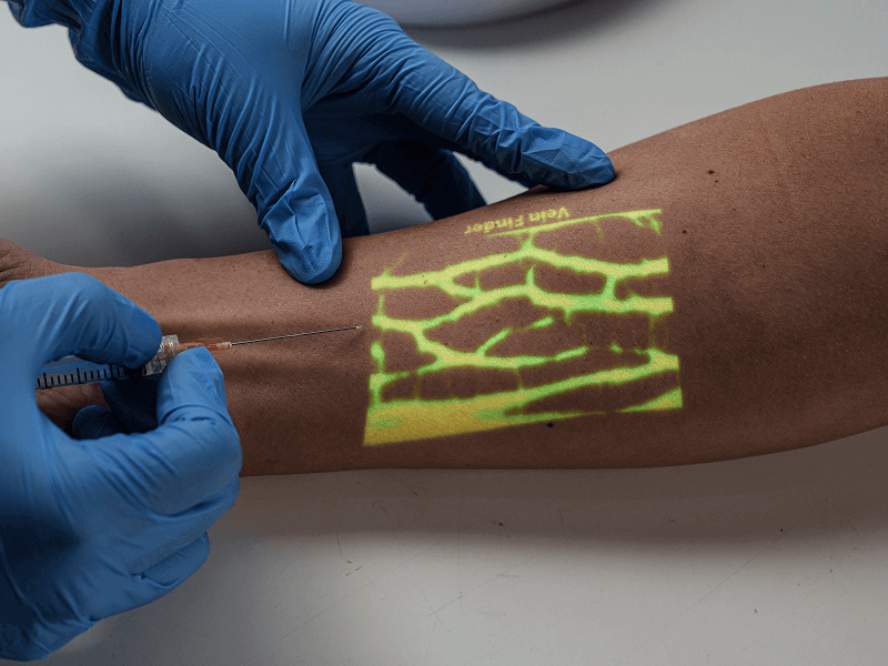 Vein finder image