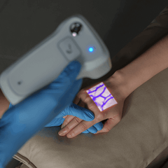 Aimvein Pro 2.0 Vein Machine For Hand