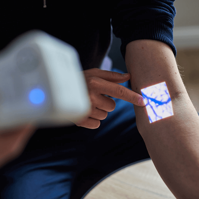 Aimvein Pro 2.0 - Portable Vein Finder