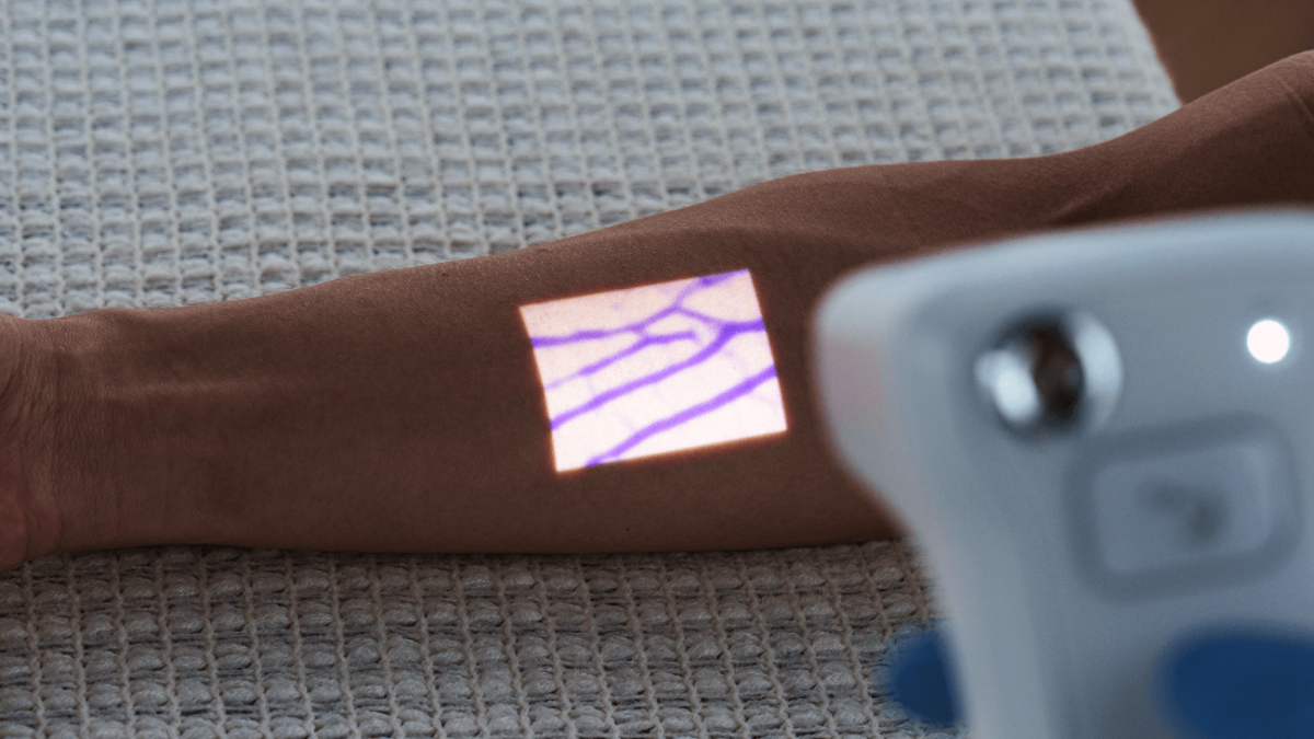 image comparison after