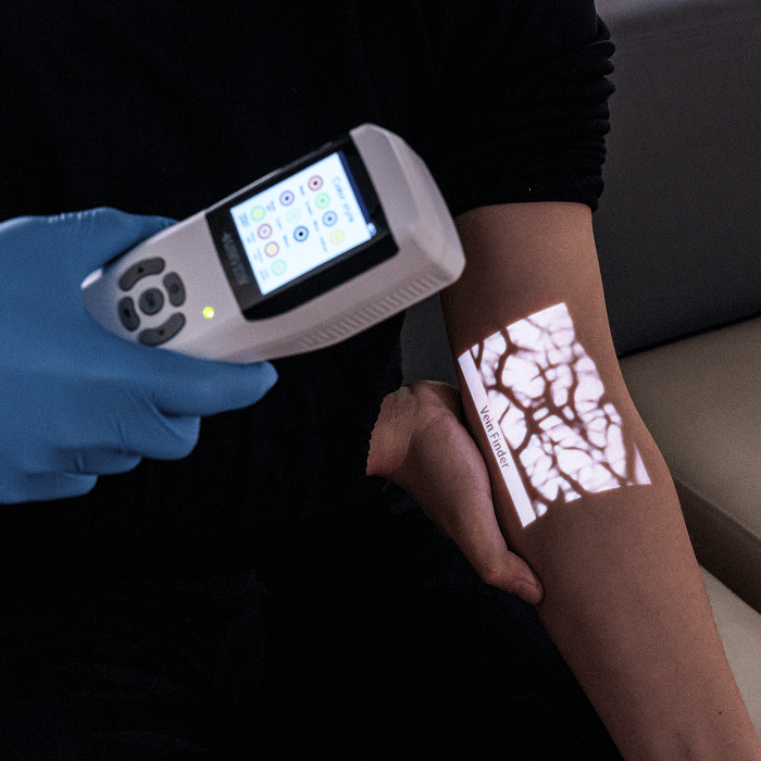 aimvein-pro-30-projection-imaging-in-chelidon