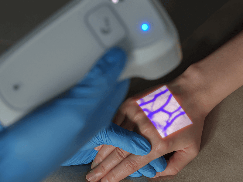 Vein finder image