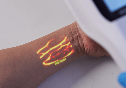 aimvein-vascular-locator-nursing-practice