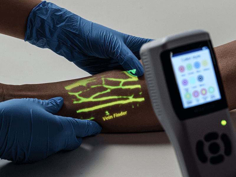 Vein finder image