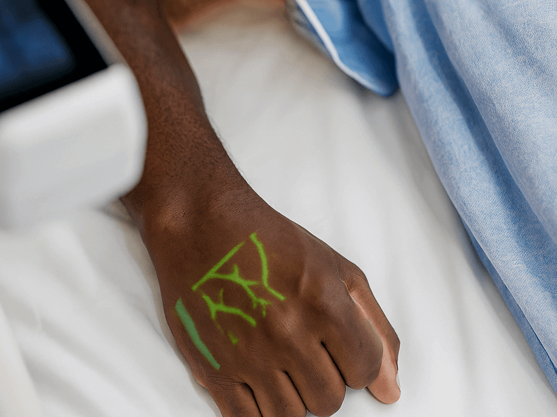 Vein finder image