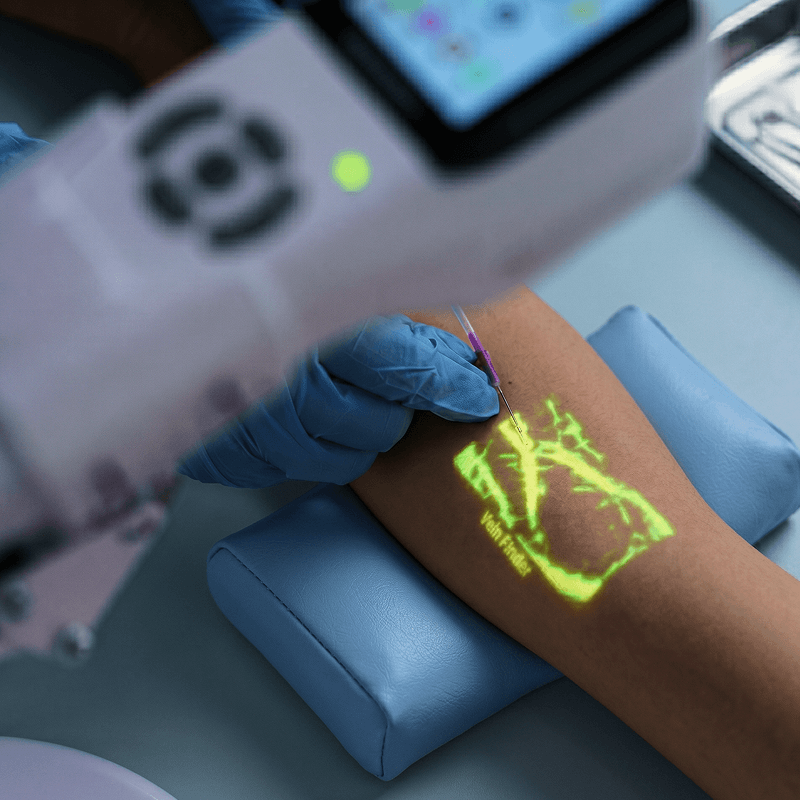 aimvein-vein-finder-pro-3-0-green-light-handheld-vein-locator-forearm-vein-viewer