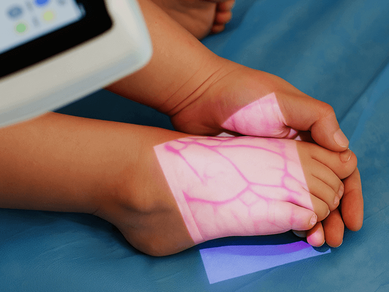 Vein finder image