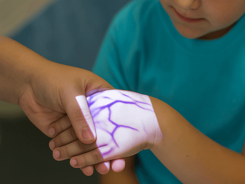 Vein finder image