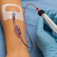 Reduction In PIV Procedure Time