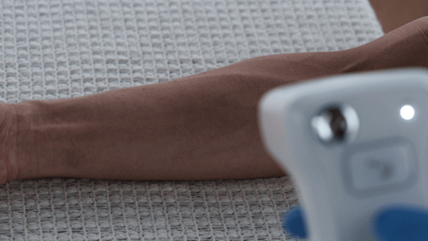 image comparison before