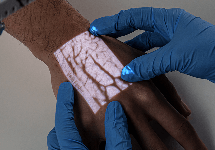 handheld-vein-finder-medical-use