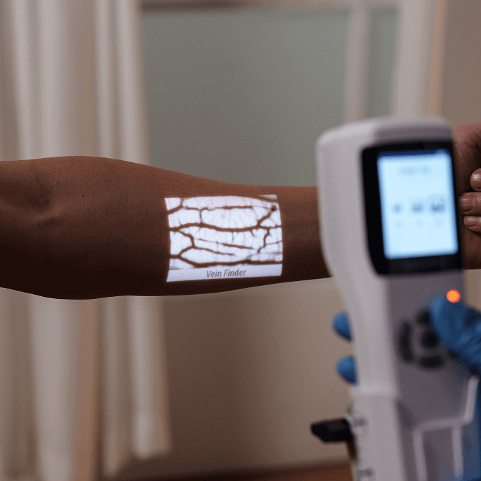 high-definition-vein-imaging-with-aimvein-pro-30-vein-finder