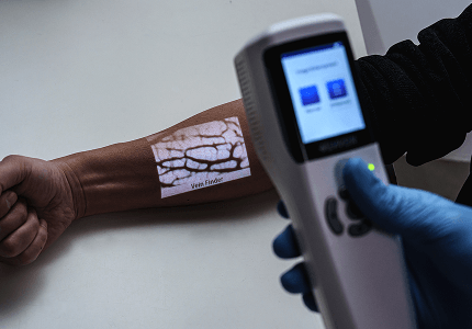 infrared-vein-finder-cosmetic-use