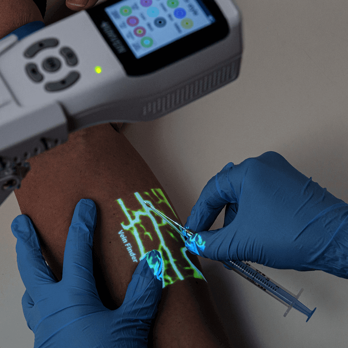 injection-with-aimvein-portable-ven-finder-pro-30