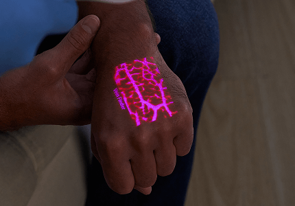 medical-vein-finder-for-phlebotomy