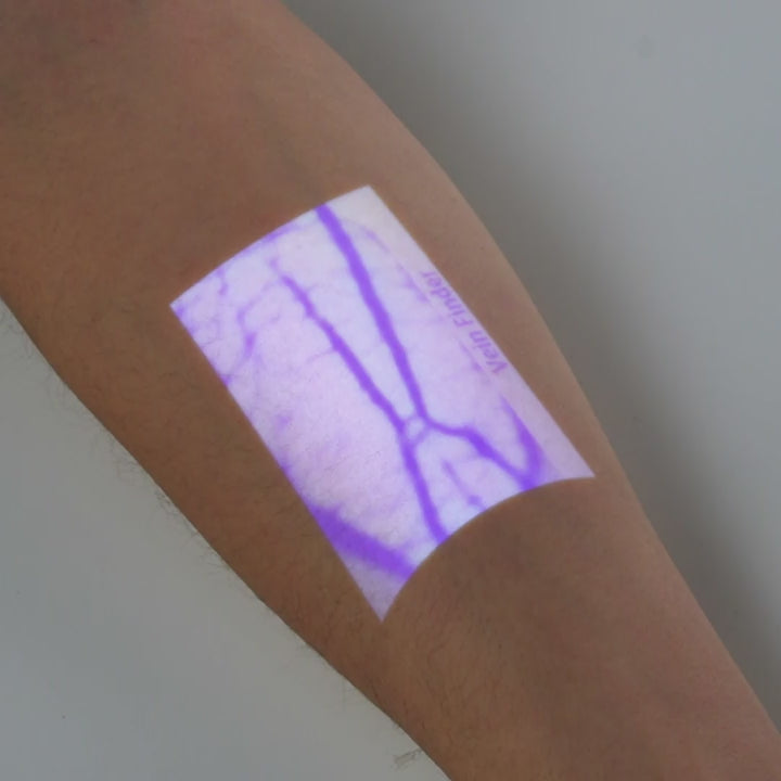 High-Accuracy-Real-Time-Vein-Movement-With-Aimvein-Vein-Finder