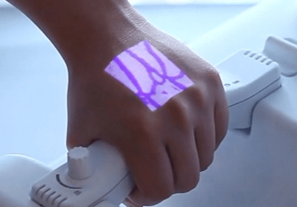 vein-finder-tool-for-nurses-aimvein