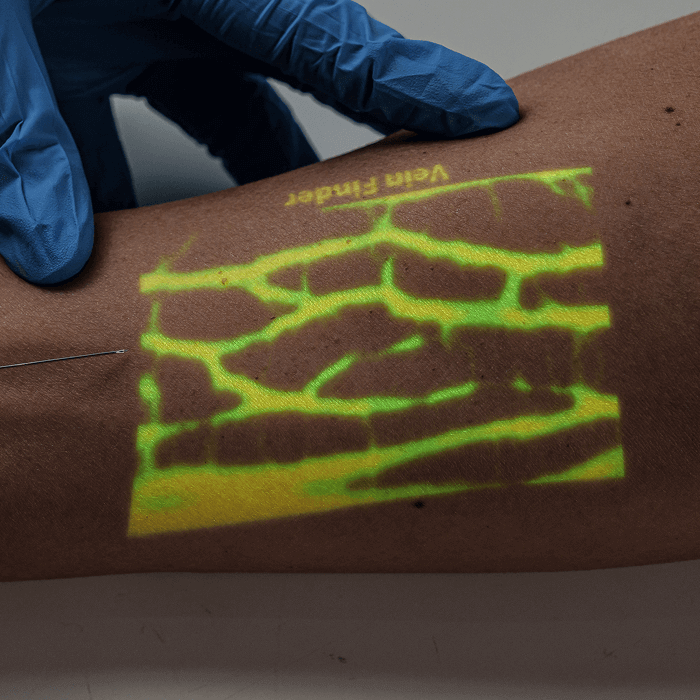vein-projection-imaging-with-aimvein-pro-30