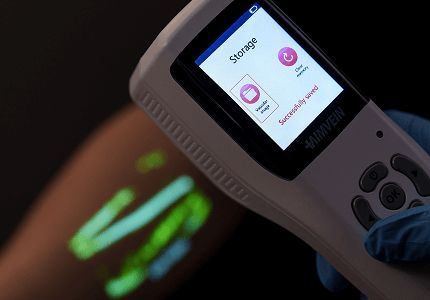 vein-visualization-device-can-save-images