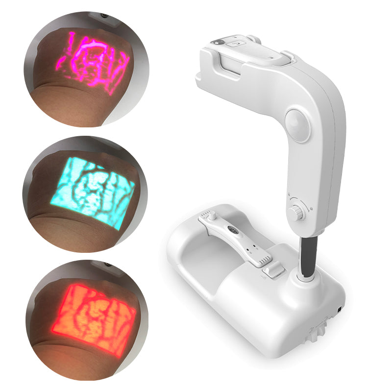 infrared vein finder image